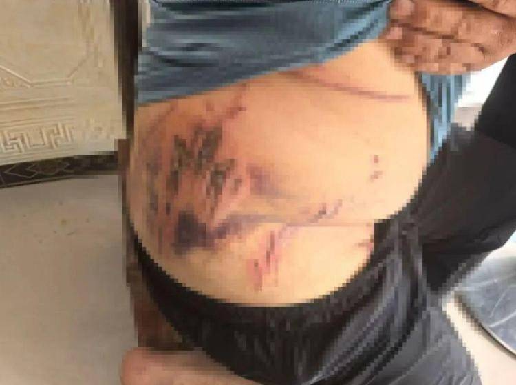 皇冠信用网占成代理_湖北鹤峰县疑再现老虎踪迹皇冠信用网占成代理，村民家猪遭袭，玉米地发现脚印，此前男子自称干农活时被抓伤，当地回应