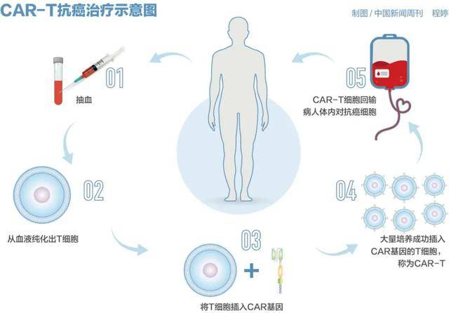 皇冠登3管理出租
_百万元的抗癌药皇冠登3管理出租
,有望大幅降价?