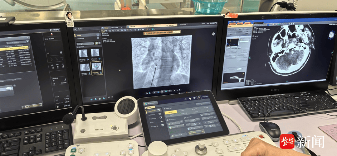 皇冠足球会员注册_36岁青年男性突发脑梗死皇冠足球会员注册，病因竟是心脏上有个“洞”！