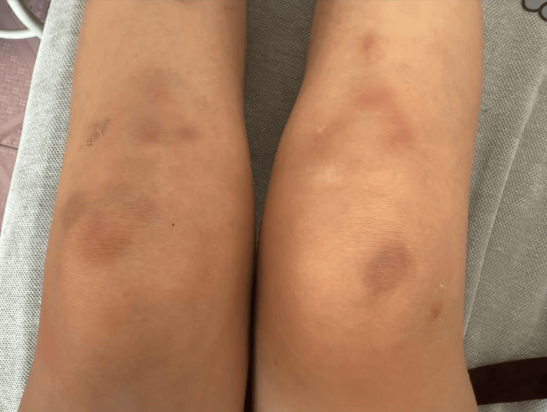 葡萄牙丙组联赛_女子自称因工资问题被老板锁办公室里打 警方：双方已到派出所葡萄牙丙组联赛，是否打人还在调查