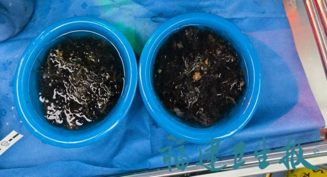 皇冠平台_发现一例皇冠平台，10岁女孩确诊！已有多起病例，有人因羞耻感延误就医