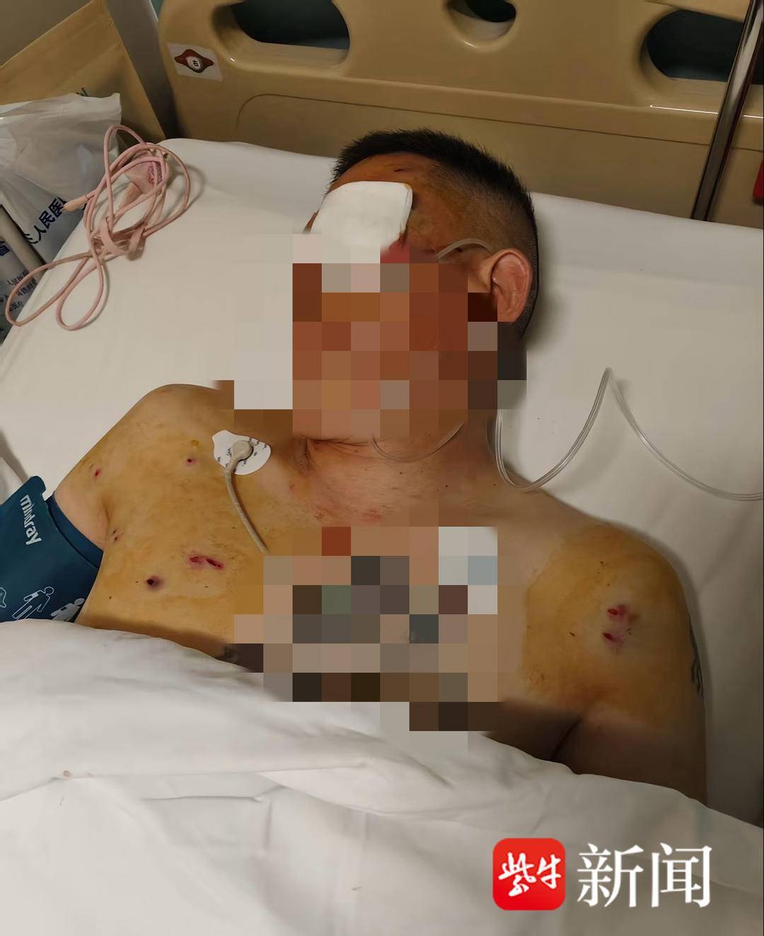 皇冠信用網代理_紫牛头条｜男子取款170万在银行门口遭抢劫致重伤皇冠信用網代理，当事人认为银行保安未帮忙应担责